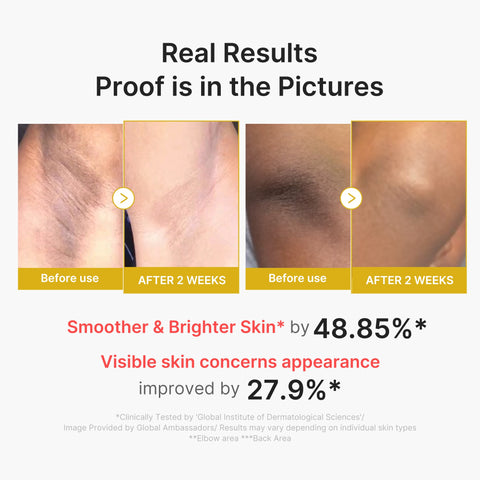 Medicube Kojic Acid Turmeric Body Peel Shot texture