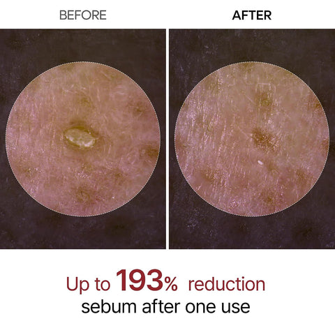 Dr.Melaxin Peel Shot Exfoliating White Rice Ampoule 80ml