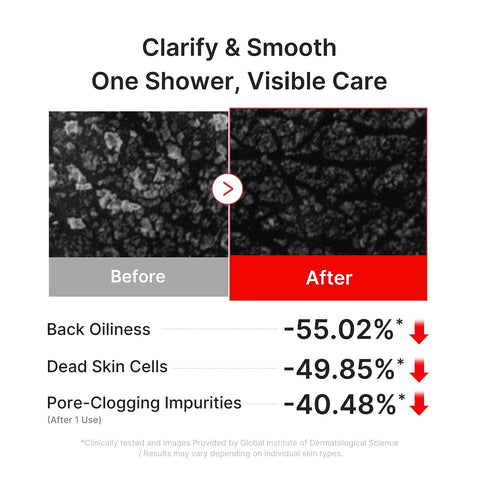 [Medicube] RED ACNE BODY WASH 3.0 400ml