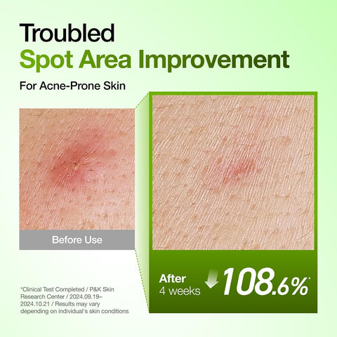 [ANUA] Azelaic Acid 10 Hyaluron Redness Soothing Serum 30ml